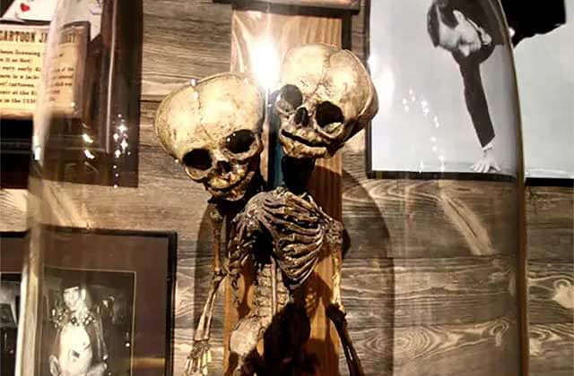 conjoined twins skeleton in a glass case at ripleys believe it or not st augustine